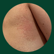 A close view of Georgie's skin